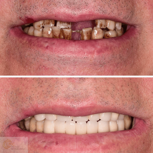 Dentist performing a checkup at Life Care Medical Centre