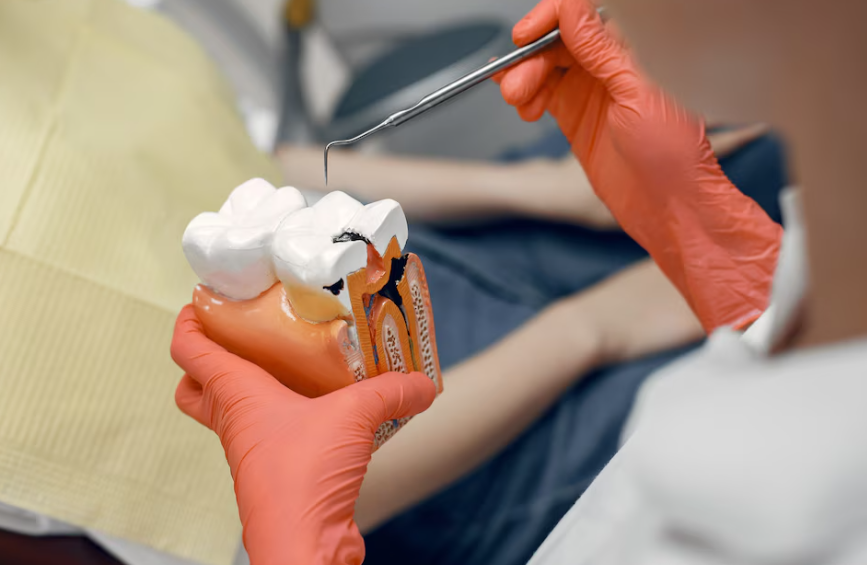 Root canal treatment procedure