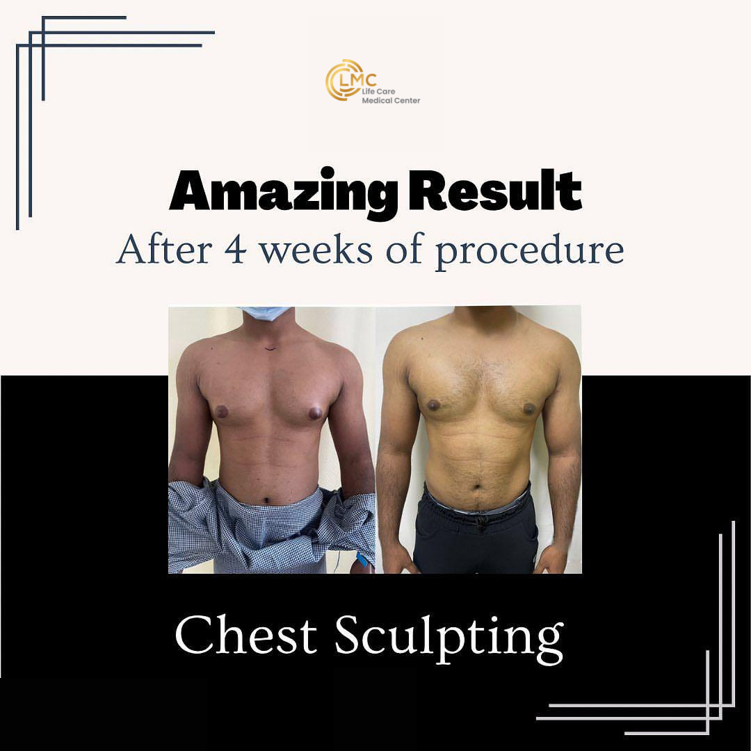 lmc plastic-surgery