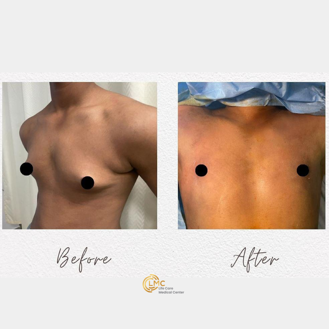 lmc plastic-surgery