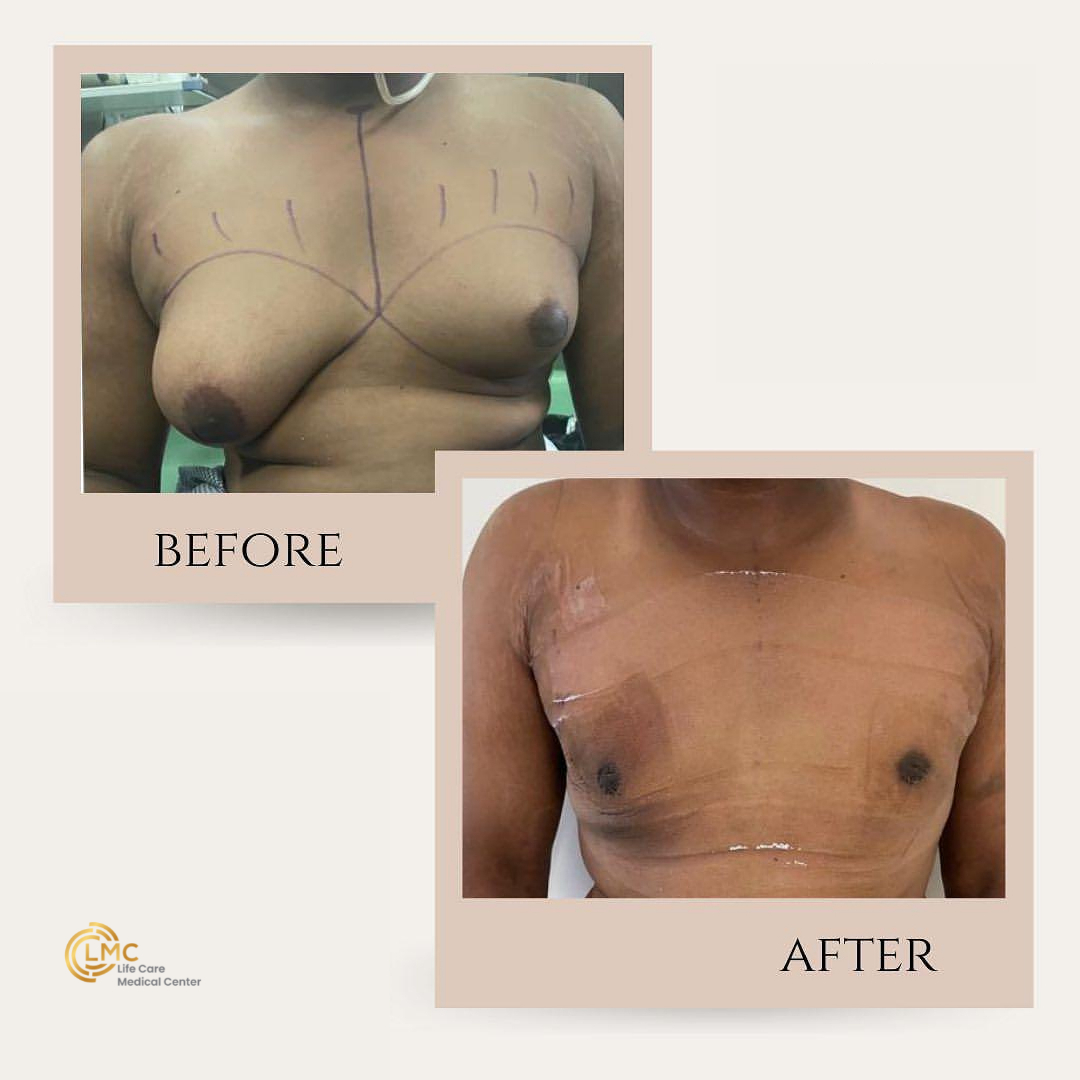lmc plastic-surgery