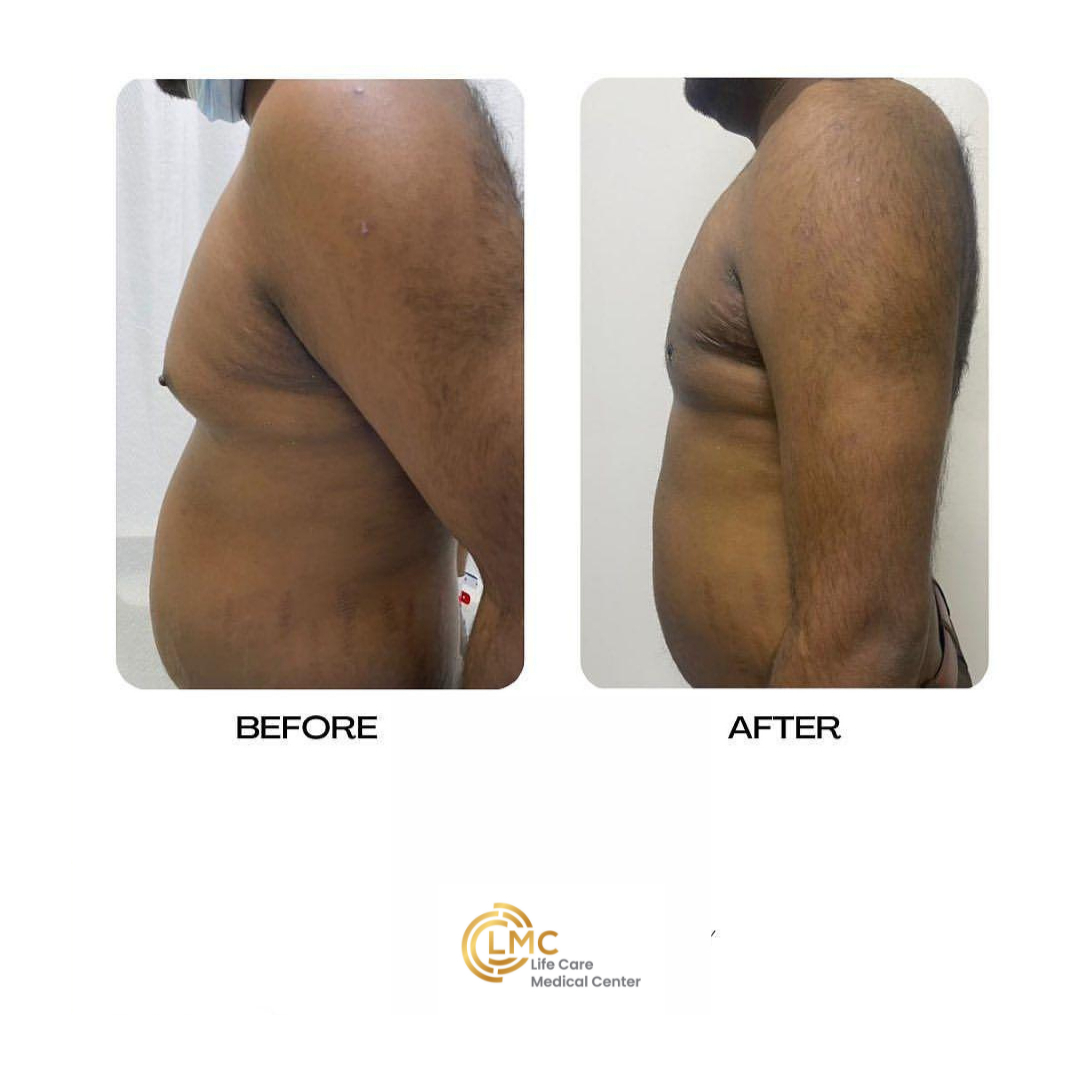 lmc plastic-surgery