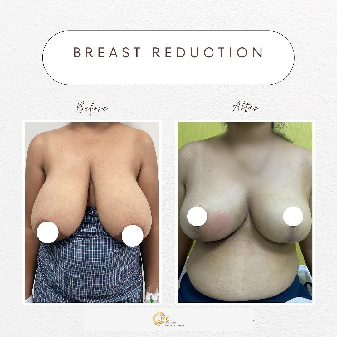 lmc plastic-surgery