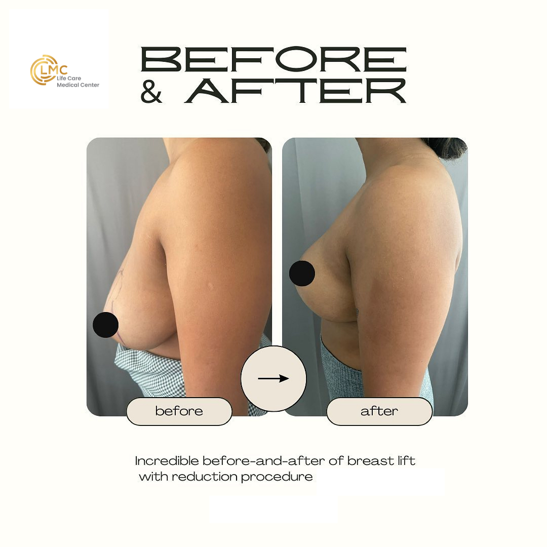 lmc plastic-surgery