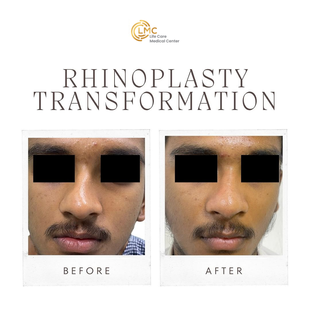 lmc plastic-surgery